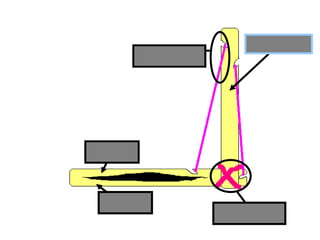 Humerus
Radius
Ulna
Ligament
Tendon
Copyright © 2010 Ryan P. Murphy
 