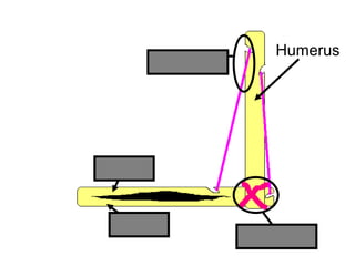 Humerus
Radius
Ulna
Ligament
Tendon
Copyright © 2010 Ryan P. Murphy
 