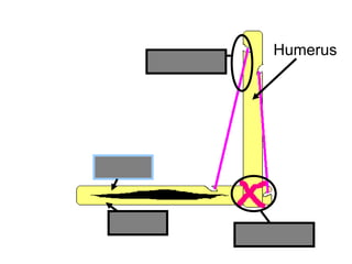 Humerus
Radius
Ulna
Ligament
Tendon
Copyright © 2010 Ryan P. Murphy
 