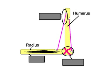 Humerus
Radius
Ulna
Ligament
Tendon
Copyright © 2010 Ryan P. Murphy
 