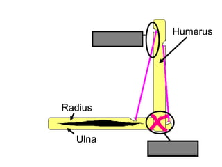 Humerus
Radius
Ulna
Ligament
Tendon
Copyright © 2010 Ryan P. Murphy
 