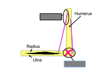Humerus
Radius
Ulna
Ligament
Tendon
Copyright © 2010 Ryan P. Murphy
 