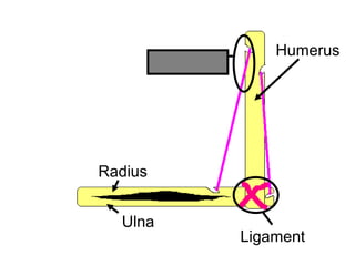 Humerus
Radius
Ulna
Ligament
Tendon
Copyright © 2010 Ryan P. Murphy
 