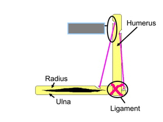 Humerus
Radius
Ulna
Ligament
Tendon
Copyright © 2010 Ryan P. Murphy
 