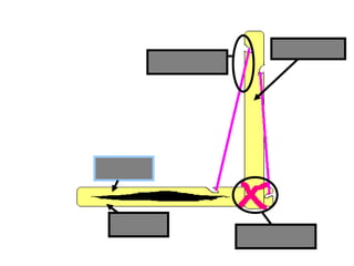 Humerus
Radius
Ulna
Ligament
Tendon
Copyright © 2010 Ryan P. Murphy
 