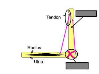 Humerus
Radius
Ulna
Ligament
Tendon
Copyright © 2010 Ryan P. Murphy
 