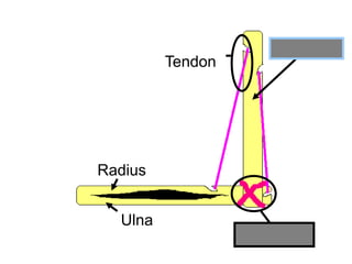 Humerus
Radius
Ulna
Ligament
Tendon
Copyright © 2010 Ryan P. Murphy
 