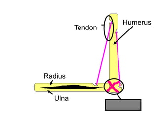 Humerus
Radius
Ulna
Ligament
Tendon
Copyright © 2010 Ryan P. Murphy
 