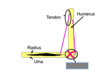 Humerus
Radius
Ulna
Ligament
Tendon
 