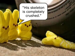 “His skeleton
is completely
crushed.”
 