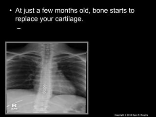 • At just a few months old, bone starts to
replace your cartilage.
–
Copyright © 2010 Ryan P. Murphy
 