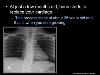 • At just a few months old, bone starts to
replace your cartilage.
– This process stops at about 25 years old and
that is when you stop growing.
Copyright © 2010 Ryan P. Murphy
 
