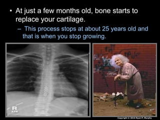 • At just a few months old, bone starts to
replace your cartilage.
– This process stops at about 25 years old and
that is when you stop growing.
Copyright © 2010 Ryan P. Murphy
 