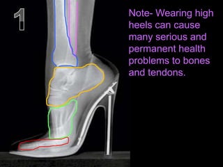 Note- Wearing high
heels can cause
many serious and
permanent health
problems to bones
and tendons.
 