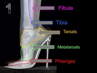 Fibula
Tibia
Tarsals
Metatarsals
Phlanges
 
