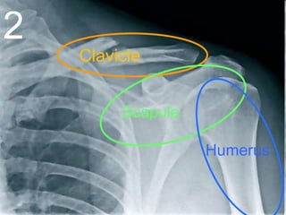 2
Clavicle
Scapula
Humerus
 