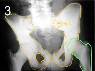 3
Pelvis
 