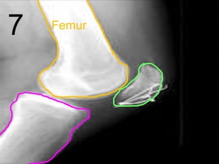 7 Femur
 