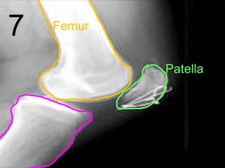 7 Femur
Patella
 