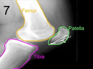 7 Femur
Patella
Tibia
 