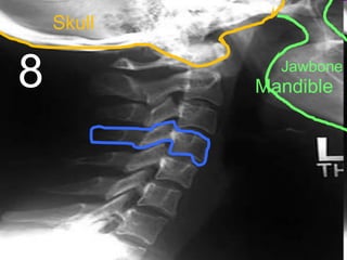 8
Skull
Jawbone
Mandible
 