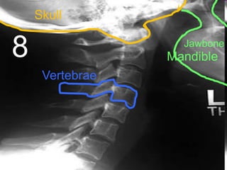 8
Skull
Jawbone
Mandible
Vertebrae
 