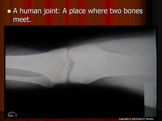  A human joint: A place where two bones
meet.
Copyright © 2010 Ryan P. Murphy
 
