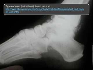 Types of joints (animations). Learn more at…
http://www.bbc.co.uk/science/humanbody/body/factfiles/joints/ball_and_sock
et_joint.shtml
 