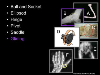 • Ball and Socket
• Ellipsod
• Hinge
• Pivot
• Saddle
• Gliding
AB
C
D
E
F
Copyright © 2010 Ryan P. Murphy
 
