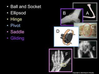 • Ball and Socket
• Ellipsod
• Hinge
• Pivot
• Saddle
• Gliding
AB
C
D
E
F
Copyright © 2010 Ryan P. Murphy
 