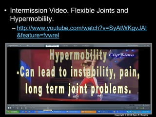 • Intermission Video. Flexible Joints and
Hypermobility.
– http://www.youtube.com/watch?v=SyAtWKgvJAI
&feature=fvwrel
Copyright © 2010 Ryan P. Murphy
 
