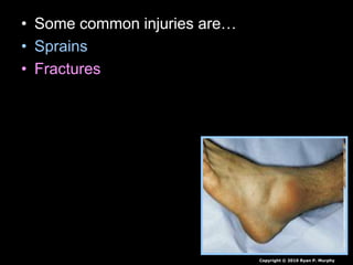 • Some common injuries are…
• Sprains
• Fractures
Copyright © 2010 Ryan P. Murphy
 