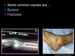 • Some common injuries are…
• Sprains
• Fractures
Copyright © 2010 Ryan P. Murphy
 