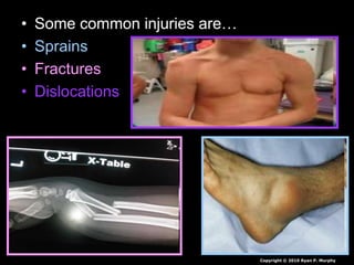 • Some common injuries are…
• Sprains
• Fractures
• Dislocations
Copyright © 2010 Ryan P. Murphy
 