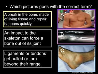 • Which pictures goes with the correct term?
A
B
C
A break in the bone, made
of living tissue and repair
happens quickly.
An impact to the
skeleton can force a
bone out of its joint
Ligaments or tendons
get pulled or torn
beyond their range
Copyright © 2010 Ryan P. Murphy
 