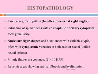 PART 2 spindle cell tumors.pptx