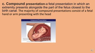 c. Compound presentation-a fetal presentation in which an
extremity presents alongside the part of the fetus closest to the
birth canal. The majority of compound presentations consist of a fetal
hand or arm presenting with the head
 