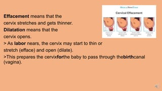 Effacement means that the
cervix stretches and gets thinner.
Dilatation means that the
cervix opens.
> As labor nears, the cervix may start to thin or
stretch (efface) and open (dilate).
>This prepares the cervixforthe baby to pass through thebirthcanal
(vagina).
 