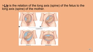 >Lie is the relation of the long axis (spine) of the fetus to the
long axis (spine) of the mother.
 