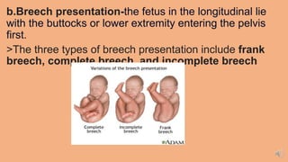 b.Breech presentation-the fetus in the longitudinal lie
with the buttocks or lower extremity entering the pelvis
first.
>The three types of breech presentation include frank
breech, complete breech, and incomplete breech
 