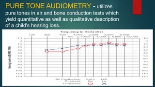 PURE TONE AUDIOMETRY - utilizes
pure tones in air and bone conduction tests which
yield quantitative as well as qualitative description
of a child's hearing loss.
 