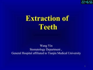 Extraction of  Teeth 1 Wang Yin Stomatology Department ,  General Hospital affiliated to Tianjin Medical University 