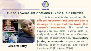 This is a complicated condition that
affects movement and posture due to
damage to a part of the brain that
controls movement. This condition
happens before birth, during birth, or
early childhood. Children with Cerebral
Palsy are characterized by "involuntary
jerking movements, a poor sense of
balance, spastic muscles, and speech
impairment” (Erickson, 1994).
EDUC 103
THE FOLLOWING ARE COMMON PHYSICAL DISABILITIES:
Cerebral Palsy
 