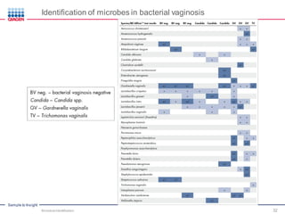 Sample to Insight
Identification of microbes in bacterial vaginosis
Microbial Identification 32
 