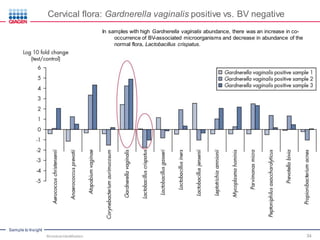 Sample to Insight
In samples with high Gardnerella vaginalis abundance, there was an increase in co-
occurrence of BV-associated microorganisms and decrease in abundance of the
normal flora, Lactobacillus crispatus.
Microbial Identification 34
Cervical flora: Gardnerella vaginalis positive vs. BV negative
 
