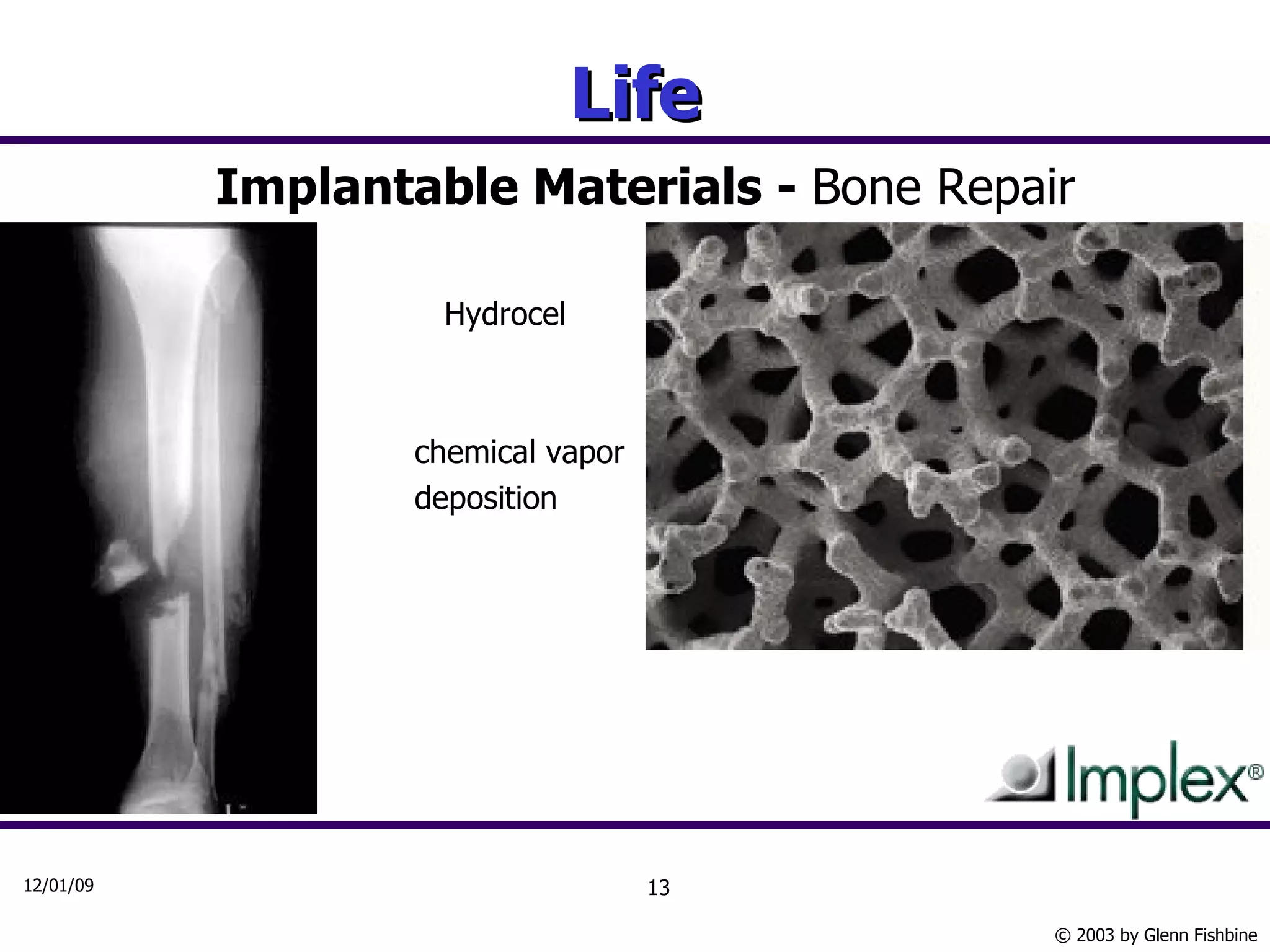 Life Implantable Materials -  Bone Repair   Hydrocel chemical vapor deposition 