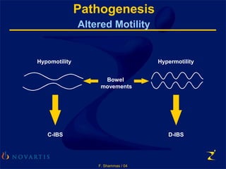 F. Shammas / 04
Pathogenesis
Altered Motility
Hypomotility
Bowel
movements
Hypermotility
C-IBS D-IBS
 