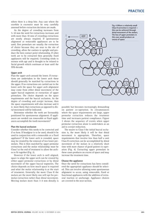 Part 4 treatment planning | PDF