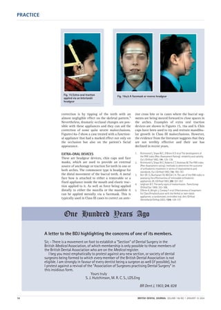 PRACTICE
18 BRITISH DENTAL JOURNAL VOLUME 196 NO. 1 JANUARY 10 2004
correction is by tipping of the teeth with an
almost negligible effect on the skeletal pattern.5
Nevertheless, dramatic occlusal changes are pos-
sible with these appliances and they can aid the
correction of some quite severe malocclusions.
Figures14a–f show a case treated with a function-
al appliance that had a marked effect not only on
the occlusion but also on the patient's facial
appearance.
EXTRA-ORAL DEVICES
These are headgear devices, chin caps and face
masks, which are used to provide an external
source of anchorage or traction for teeth in one or
both arches. The commonest type is headgear for
the distal movement of the buccal teeth. A metal
face bow is attached to either a removable or a
fixed appliance inside the mouth and elastic trac-
tion applied to it. As well as force being applied
distally to either the maxilla or the mandible it
can be applied mesially via a facemask. This is
typically used in Class III cases to correct an ante-
rior cross bite or in cases where the buccal seg-
ments are being moved forward to close spaces in
the arches. Examples of extra oral traction
devices are shown in Figures 15, 16a and b. Chin
caps have been used to try and restrain mandibu-
lar growth in Class III malocclusions. However,
the evidence from the literature suggests that they
are not terribly effective and their use has
declined in recent years.
1. Richmond S, Shaw W C, O'Brien K D etal.The development of
the PAR index (Peer Assessment Rating): reliability and validity.
EurJOrthod 1992; 14: 125-139.
2. Richmond S, Shaw W C, Roberts C T, Andrews M. The PAR index
(Peer Assessment rating): methods to determine the outcome
of orthodontic treatment in terms of improvements and
standards. EurJOrthod 1992; 14: 180-187.
3. Kerr W J S, Buchanan I B, McColl J H. The use of the PAR index in
assessing the effectiveness of removable orthodontic
appliances. BrJOrthod1993; 20: 351-357.
4. Leighton B C. The early signs of malocclusion. TransEurop
OrthodSoc 1969; 353-368.
5. O'Brien K, Wright J, Conboy F etal. Effectiveness of treatment
for Class II malocclusion with the Herbst or twin-block
appliances: a randomized, controlled trial. AmJOrthod
DentofacialOrthop 2003; 124: 128-137.
Fig. 16a,b A facemask or reverse headgearFig. 15 Extra-oral traction
applied via an Interlandii
headgear
A letter to the BDJ highlighting the concerns of one of its members.
Sir, - There is a movement on foot to establish a “Section” of Dental Surgery in the
British Medical Association, of which membership is only possible to those members of
the British Dental Association who are on the Medical register.
I beg you most emphatically to protest against any new section, or society of dental
surgeons being formed to which every member of the British Dental Association is not
eligible. I am strongly in favour of every dentist being a surgeon as well (if possible), but
I protest against a revival of the “Association of Surgeons practising Dental Surgery” in
this insidious form.
Yours truly
S. J. Hutchinson, M. R. C. S., LDS.Eng
BR DentJ,1903;24:828
One Hundred Years Ago
01p9-18.qxd 04/12/2003 14:42 Page 18
 