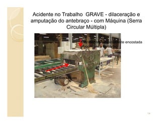 Acidente no Trabalho GRAVE - dilaceração e
amputação do antebraço - com Máquina (Serra
Circular Múltipla)
Portinhola simplesmente encostada
(com serra de corte)
Entrada das tábuas
14
 